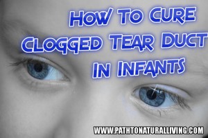 Blocked Tear Duct in Infants