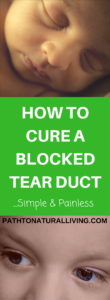 Learn how to cure a blocked tear duct in infants. It's a simple and effective solution that is pain-free for baby (and Mom too).